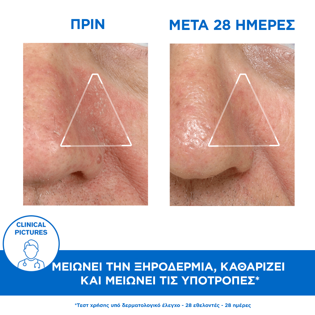 Uriage D.S. Emulsion, Κρέμα Προσώπου & Σώματος για Σμηγματόρροια Τριχωτού από 0 μηνών, 40ml