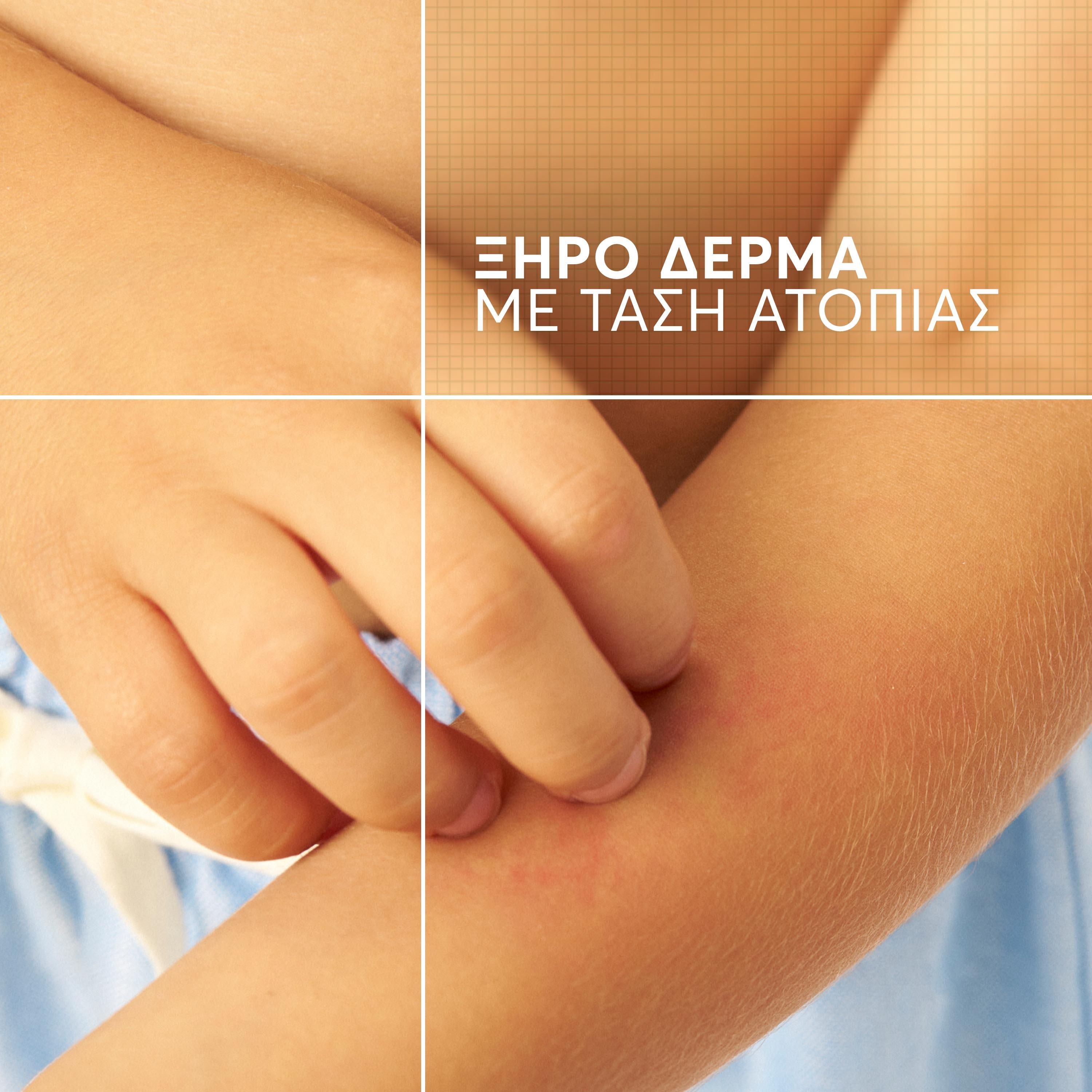A-Derma Exomega Control Kαταπραϋντικό Μαλακτικό Βάλσαμο κατά του Αισθήματος Κνησμού με Βρώμη, 200 ml