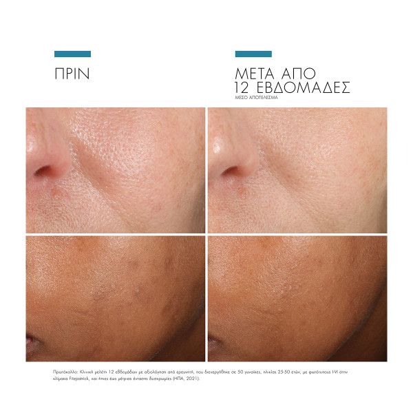 SkinCeuticals Phloretin CF, Aντιοξειδωτικός ορός Υψηλής δράσης για Πρόληψη και Αντιμετώπιση των Σημαδιών Γήρανσης  με Βιταμίνη C και Φλορετίνη 30ml
