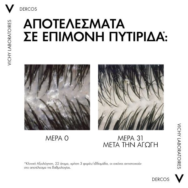 Vichy Dercos Anti Dandruff, Σαμπουάν για Ξηρά Μαλλιά,Refill  390ml