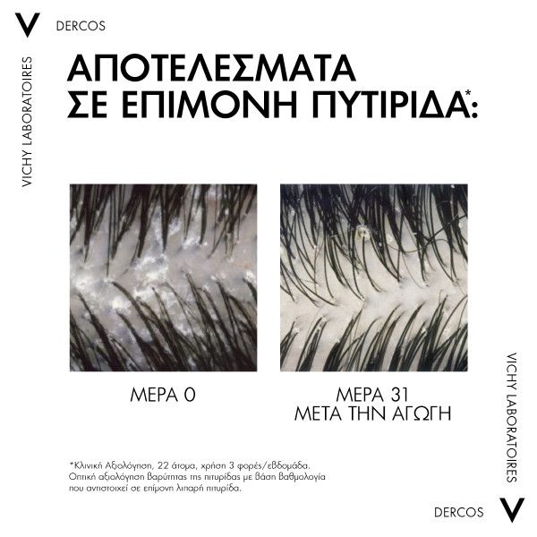 Vichy Dercos Anti-Dandruff DS Σαμπουάν κατά της πιτυρίδας για Κανονικά & Λιπαρά μαλλιά, Refill 390ml