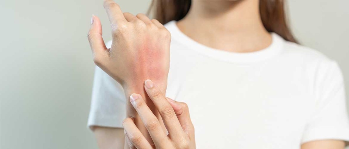 Atopische Dermatitis (Ekzem): Symptome und Ursachen Foto